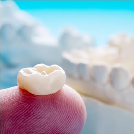Dental crown on dentist's fingertip during restorative dentistry treatment