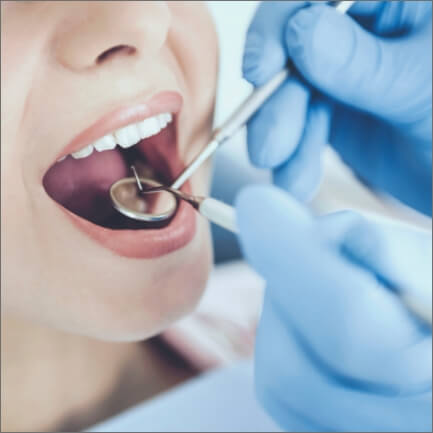 Closeup of dental patient receiving oral cancer screening