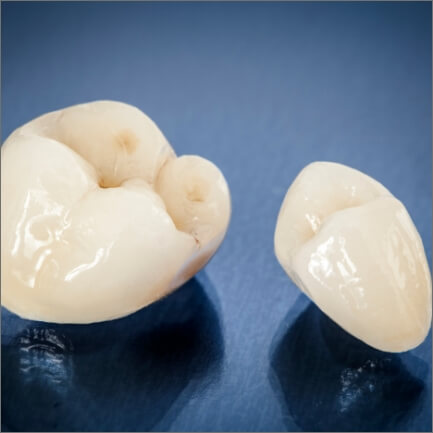 Two dental crowns prior to placement