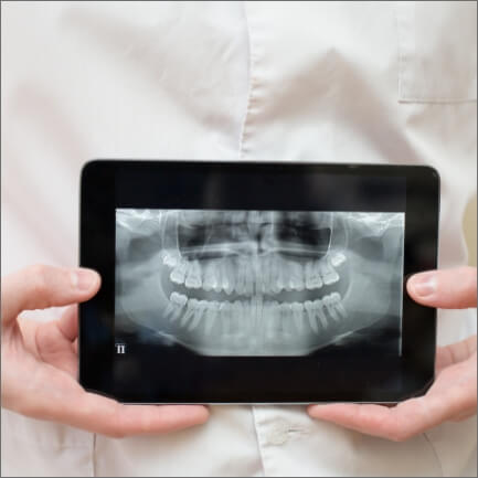 Dentist holding tablet computer with digital x rays