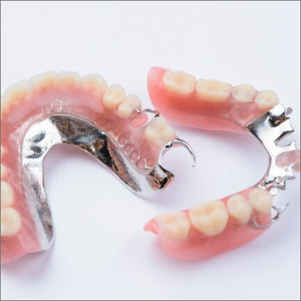 Two types of partial dentures