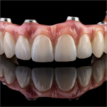 Dental implant dentures prior to placement