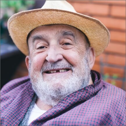 Smiling man with one missing tooth