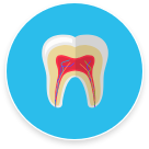 Animated inside of a tooth in need of root canal treatment