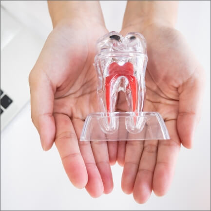 Model tooth used to explain root canal treatment