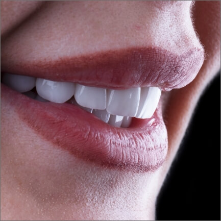 Closeup of beautiful smile after dental bonding from the cosmetic dentist