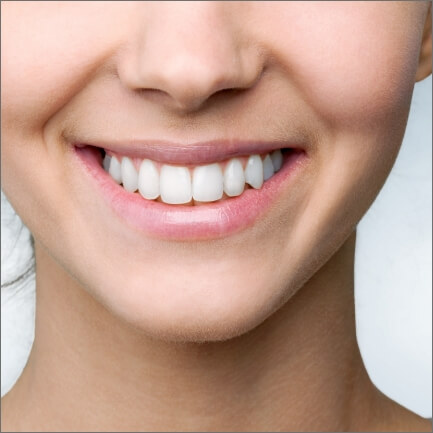 Closeup of bright smile after Kor teeth whitening