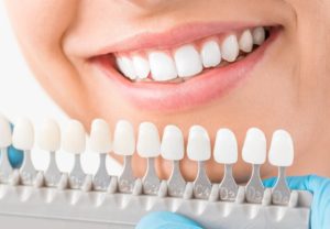 woman smiling behind dental crowns