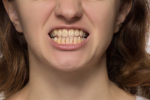 a woman with crooked teeth