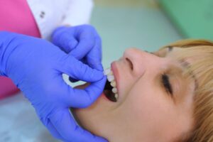 Patient having veneer installed on front tooth.
