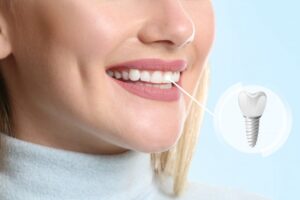 Woman smiling with a front tooth dental implant